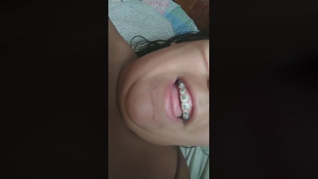 Gordelicia_luxo  07-11-2022